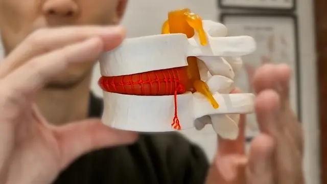 Fisioterapeuta segura um modelo das juntas